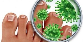 Como tratar unha infección fúngica no dedo