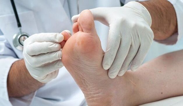 Tratamento e diagnóstico de fungos por un médico