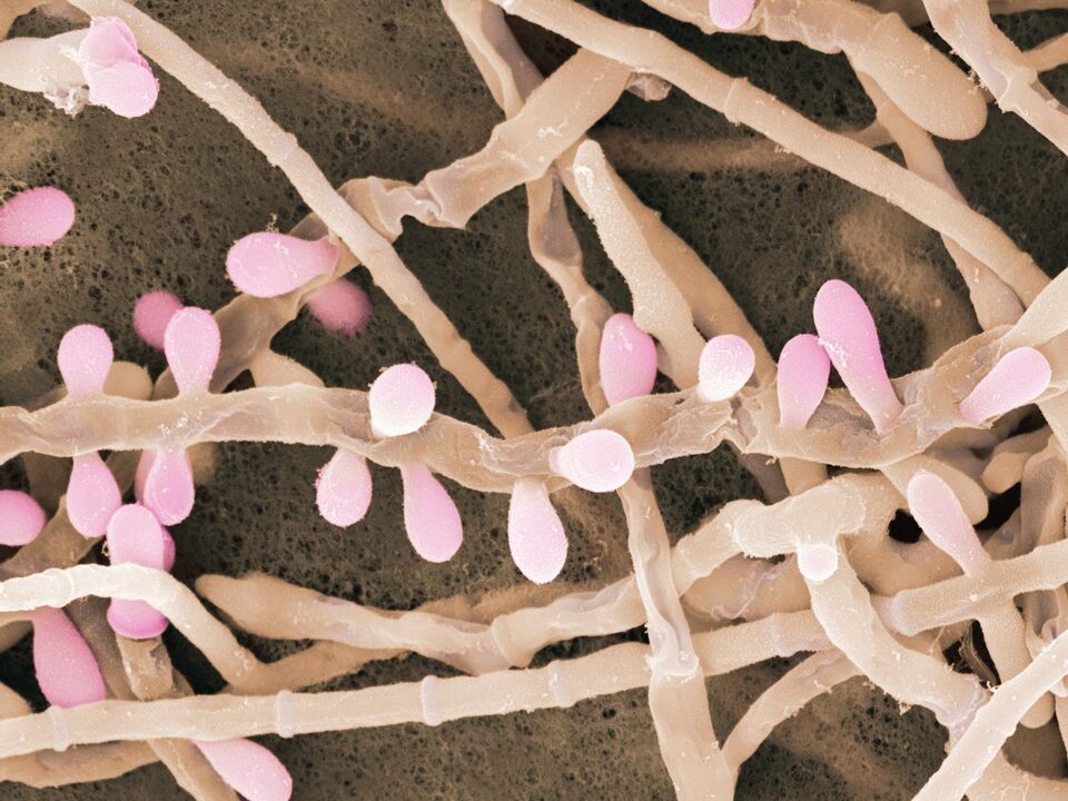 Trichophyton rubrum é un tipo de fungo que afecta a pel dos pés.